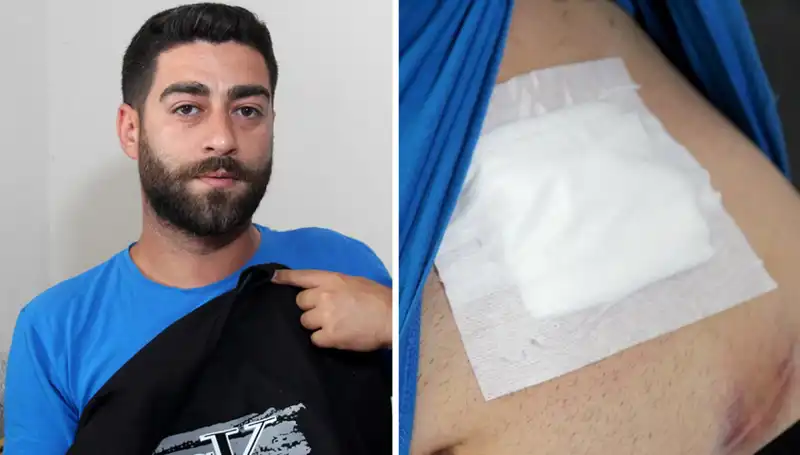 Karnındaki Ağrı Gerçeği: Röntgen Tekniğiyle Belirlenen Şok Edici Sonuç