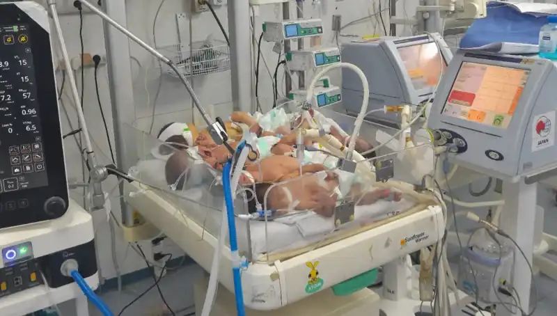 Gazzeli Doktorlar Çaresizlik İçinde: Birden Fazla Bebek Aynı Kuvözde