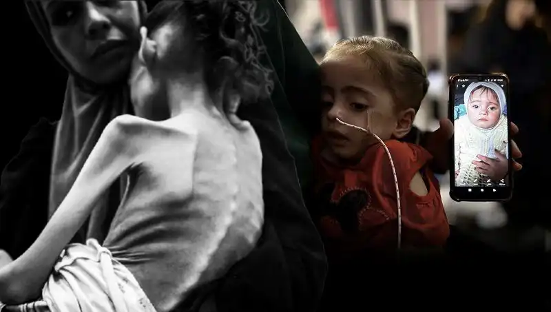 Küçük Meryem'in Akıl Almaz Hikayesi: Açlıkla Mücadele İçin 25 Kilodan 10 Kiloya Düşişi
