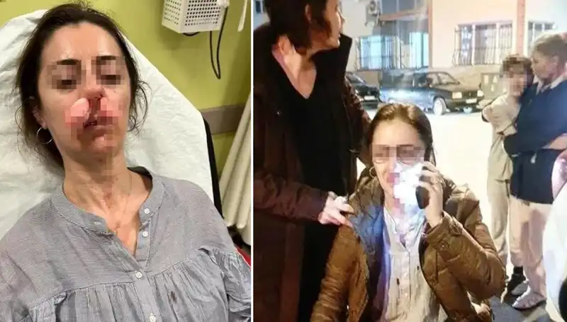 Otomobil Kapısıyla Saldırdı: Eşinin Sevgilisi Sandığı Kişiye Şok Tekme!